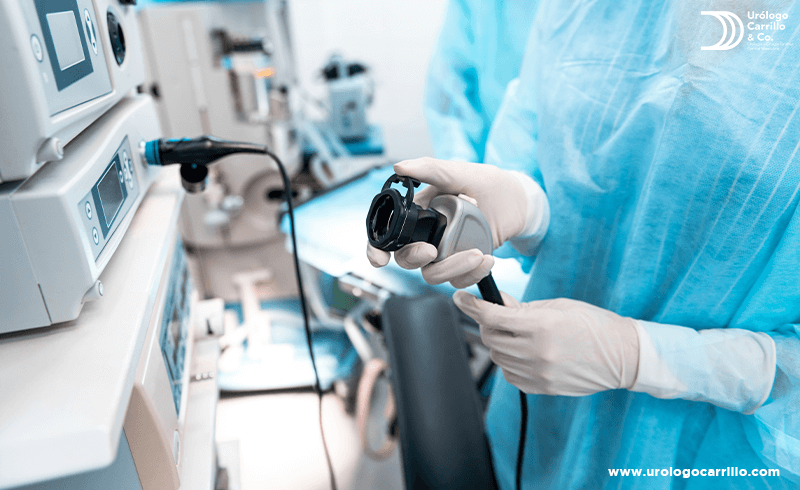 Las ondas de choque LEOC son un tratamiento común para la litiasis renal