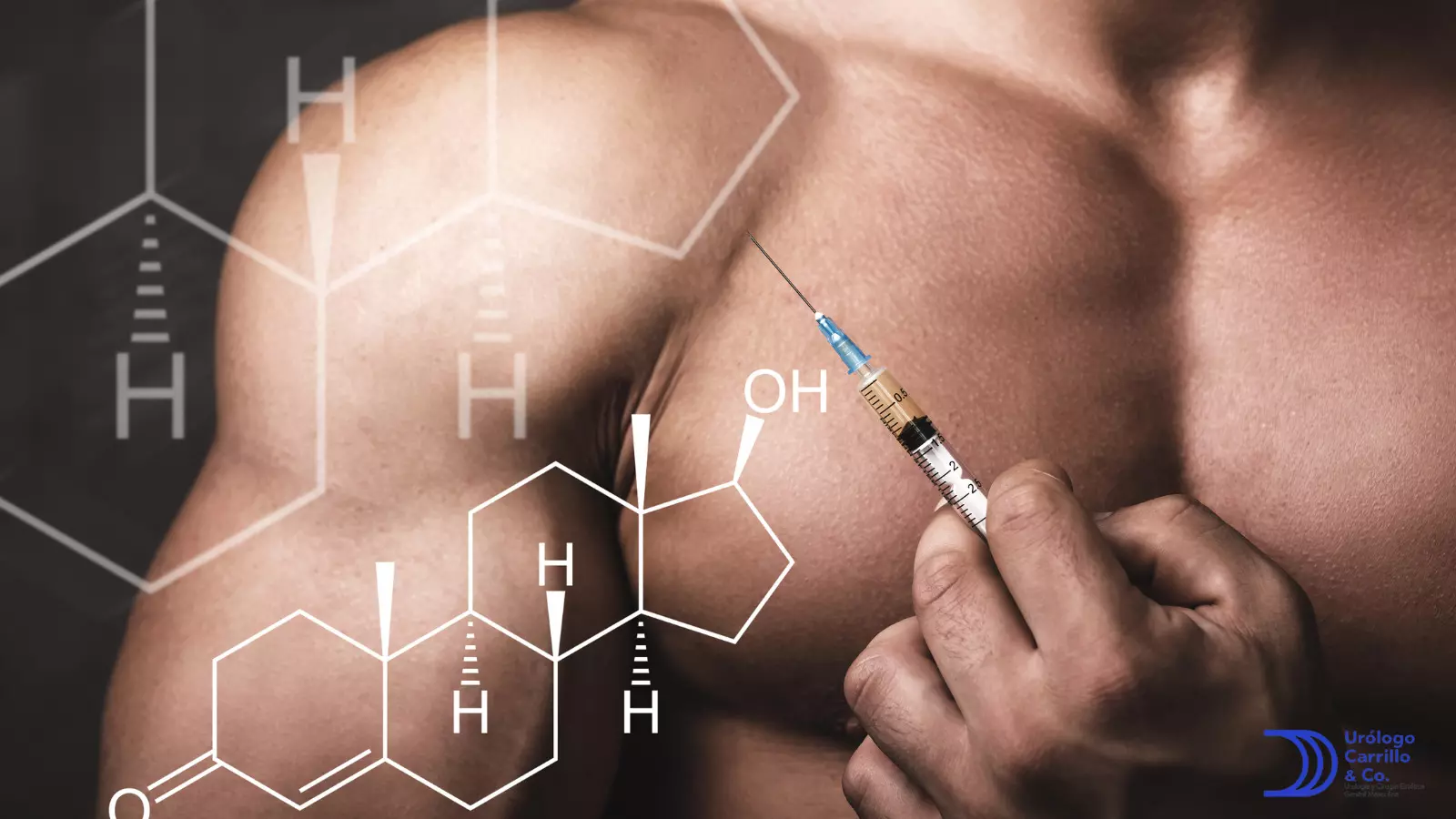 Tu médico te podrá decir cual es la mejor opción de testosterona inyectable  para ti