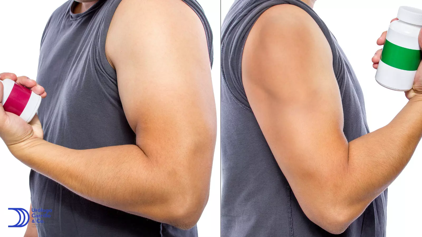 La testosterona en gel tiene importantes cambios en el desarrollo muscular 