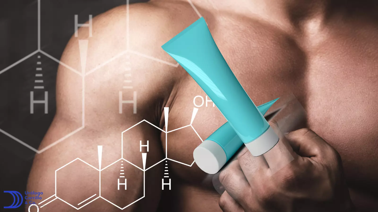 La testosterona en gel es una opción cómoda y segura para el remplazo de testosterona 