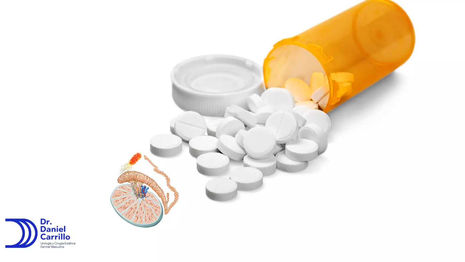 Los antibióticos son de los tratamientos mas utilizados 