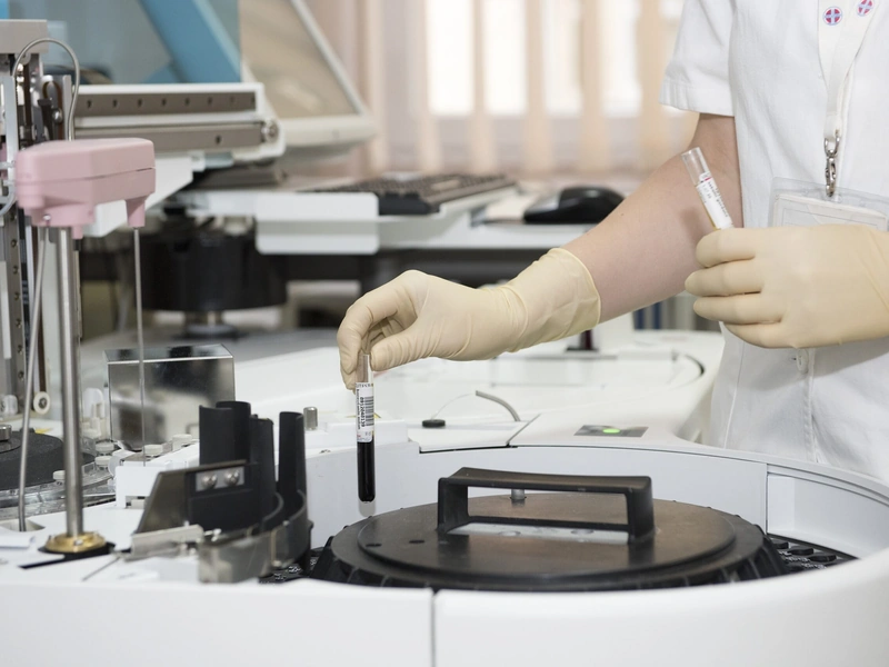 Técnico de laboratorio que usa guantes y manipula tubos de ensayo en un laboratorio clínico.