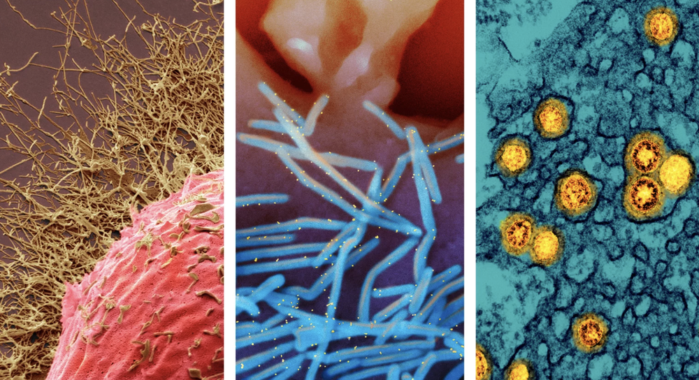The Tripledemic: Why Viruses Are Hitting Harder This Year and What Can Be Done