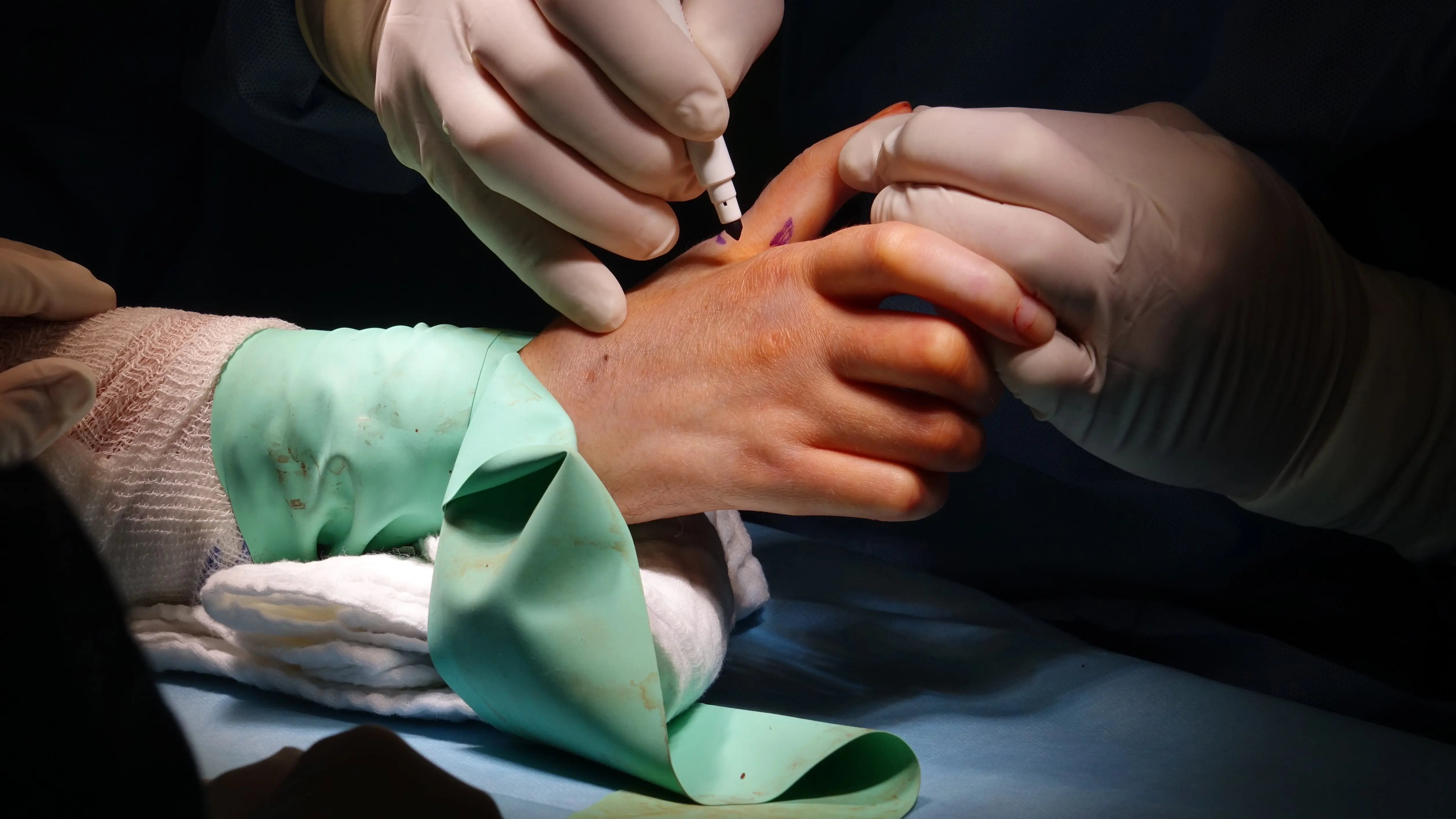 Nerve Damage After a Car Accident in Florida: What Compensation You Can Actually Recover
