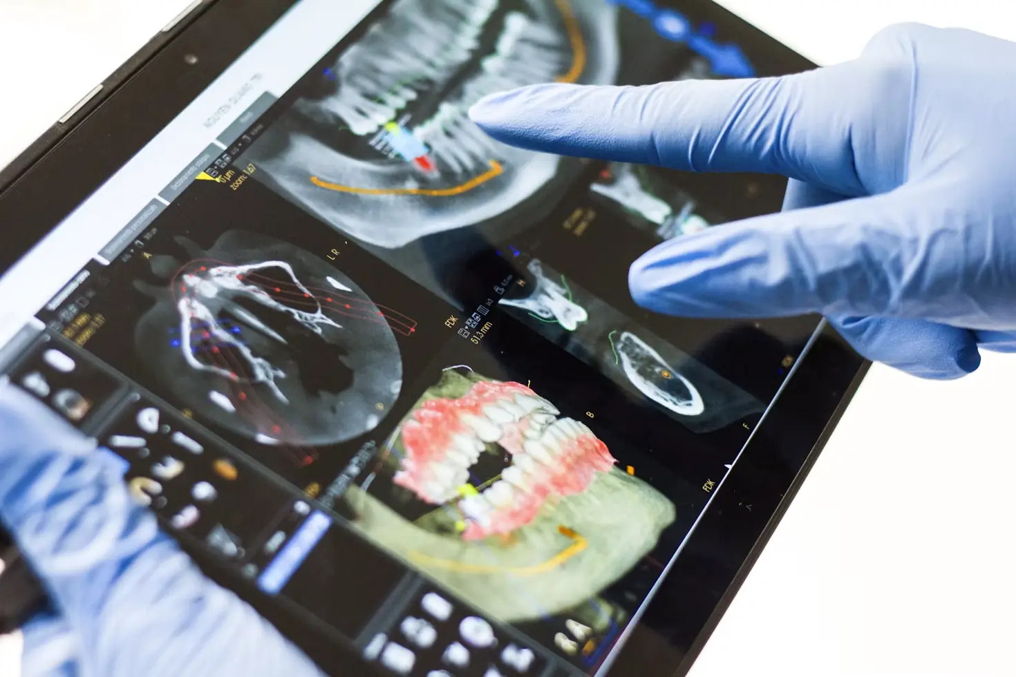 How Louis Berk Law Evaluates Dental Malpractice Cases