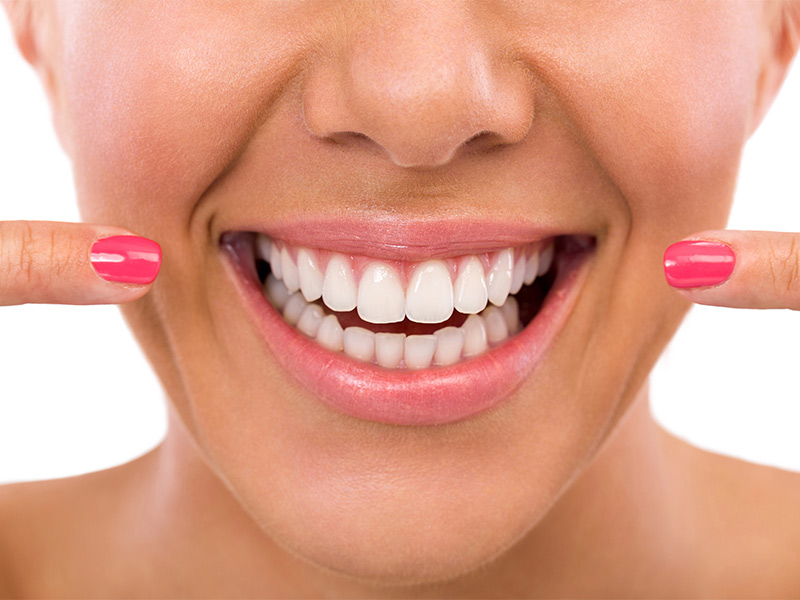 5 Ways Professional Teeth Whitening Outshines Over-the-Counter Products