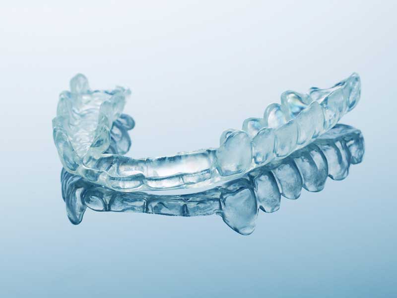 Custom Mouthguards Prevent More Injuries | Riverside, CA