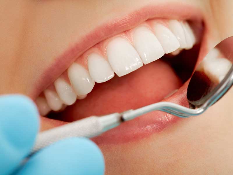 What Does Toothpaste Do? | Teeth Cleanings | Riverside, CA