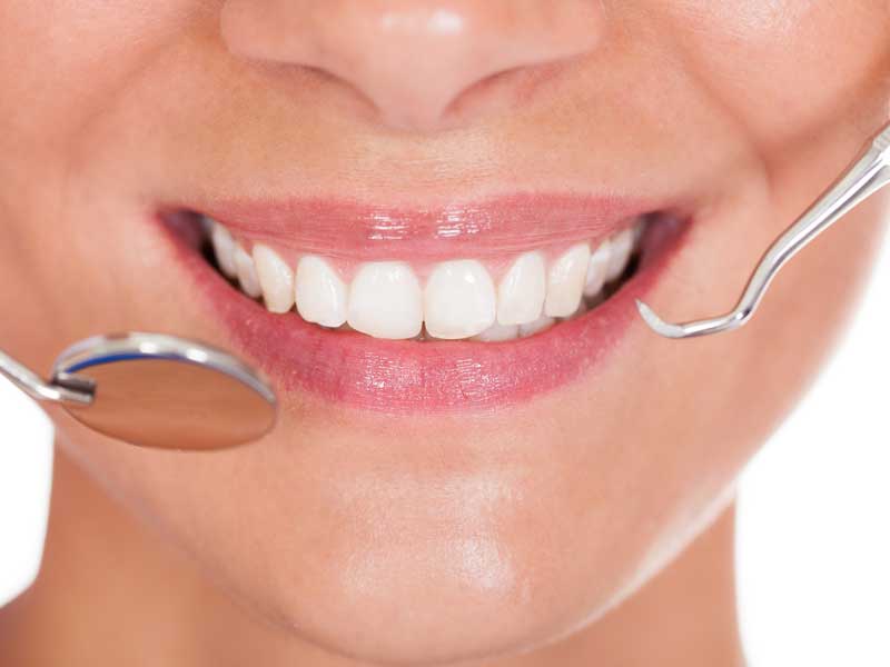 Why Are My Teeth Discolored? I Brush! | Riverside Dentist