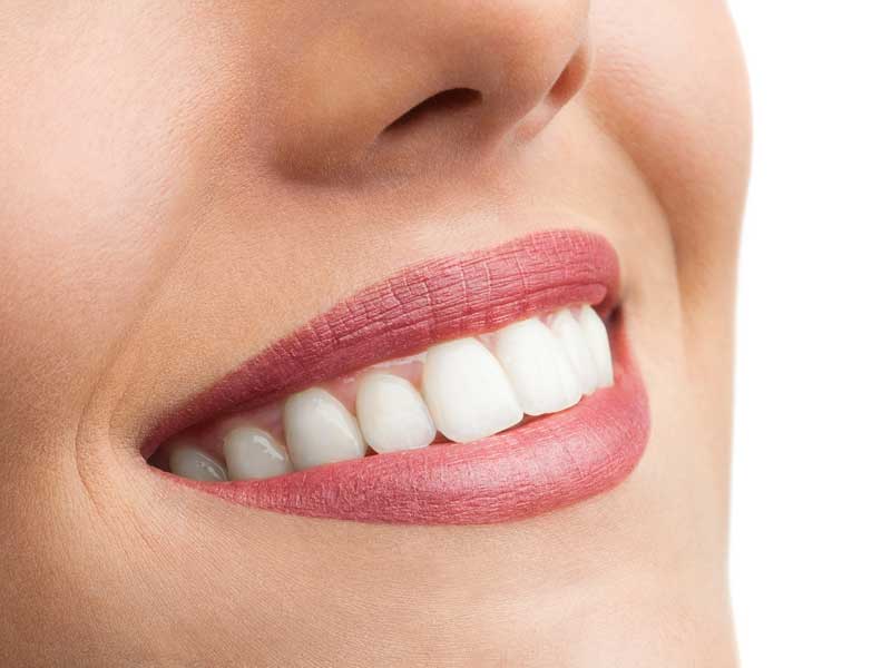Zoom Teeth Whitening, for a Brite White Smile | Riverside, California