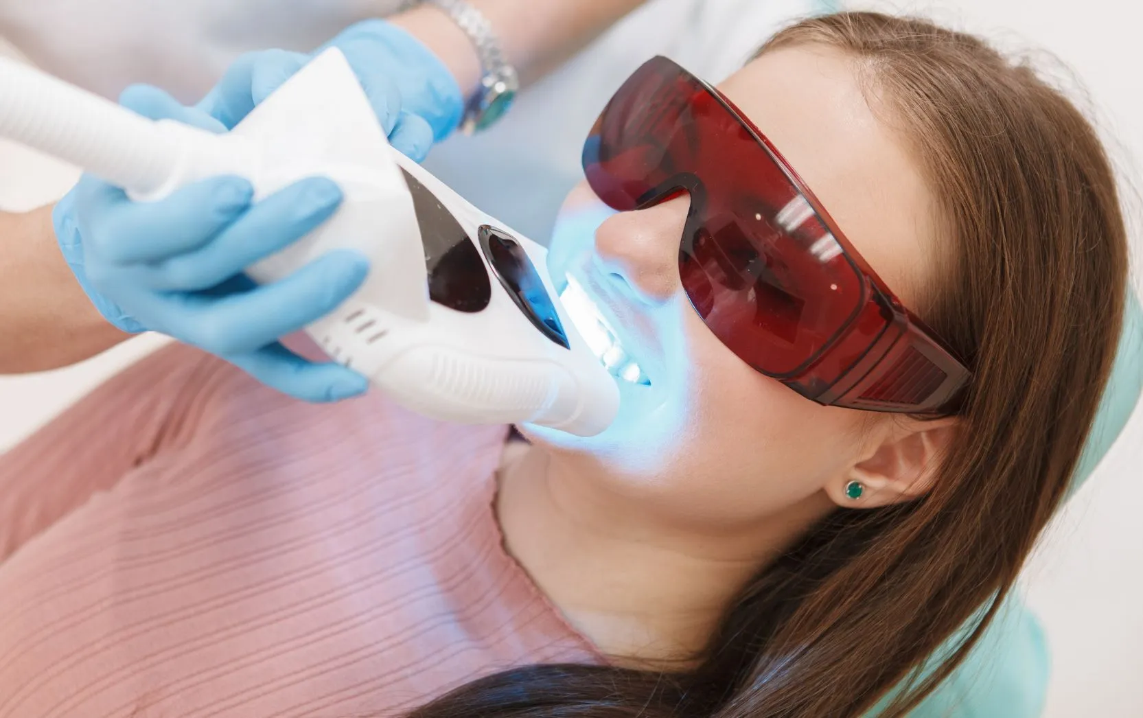 A young woman reclines calmly in a dental chair wearing oversized protective red glasses as a clinician in blue gloves positions a powerful LED whitening device near her open mouth, where the intense blue light bathes her teeth in a concentrated glow, reflecting the advanced and meticulous nature of modern cosmetic dental procedures
