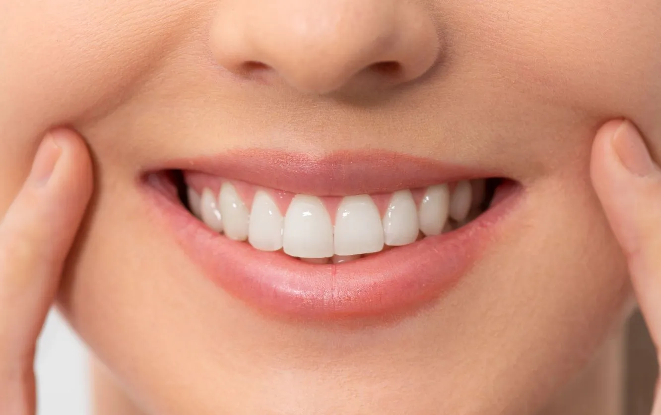 Close-up of a smiling mouth showing straight, white teeth with lips slightly parted and index fingers gently pressing at the corners of the smile.