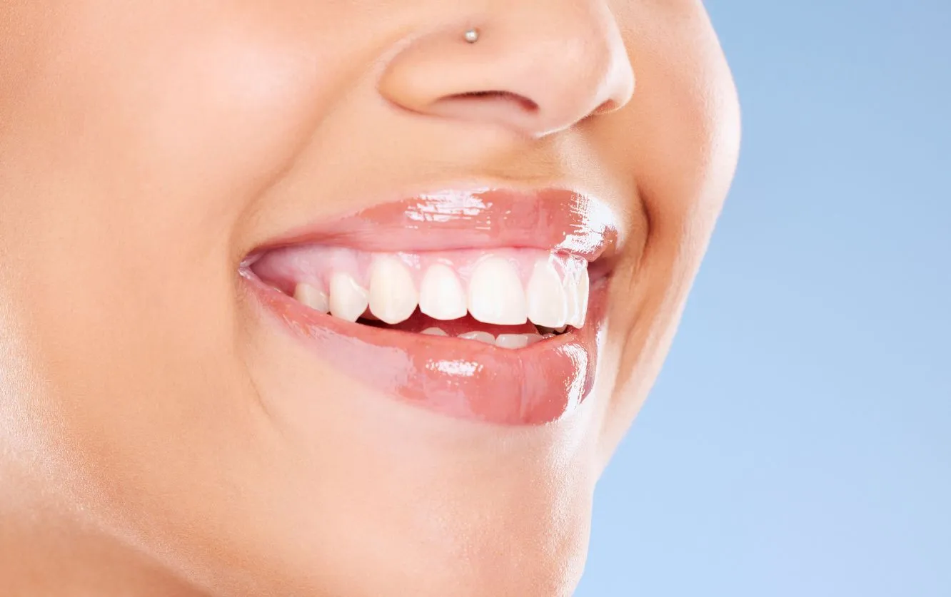 A close-up of a joyful smile reveals perfectly aligned, radiant white teeth framed by glossy, peach-toned lips and complemented by a small, elegant nose stud, all set against a soft blue background that enhances the fresh, vibrant feel of the image