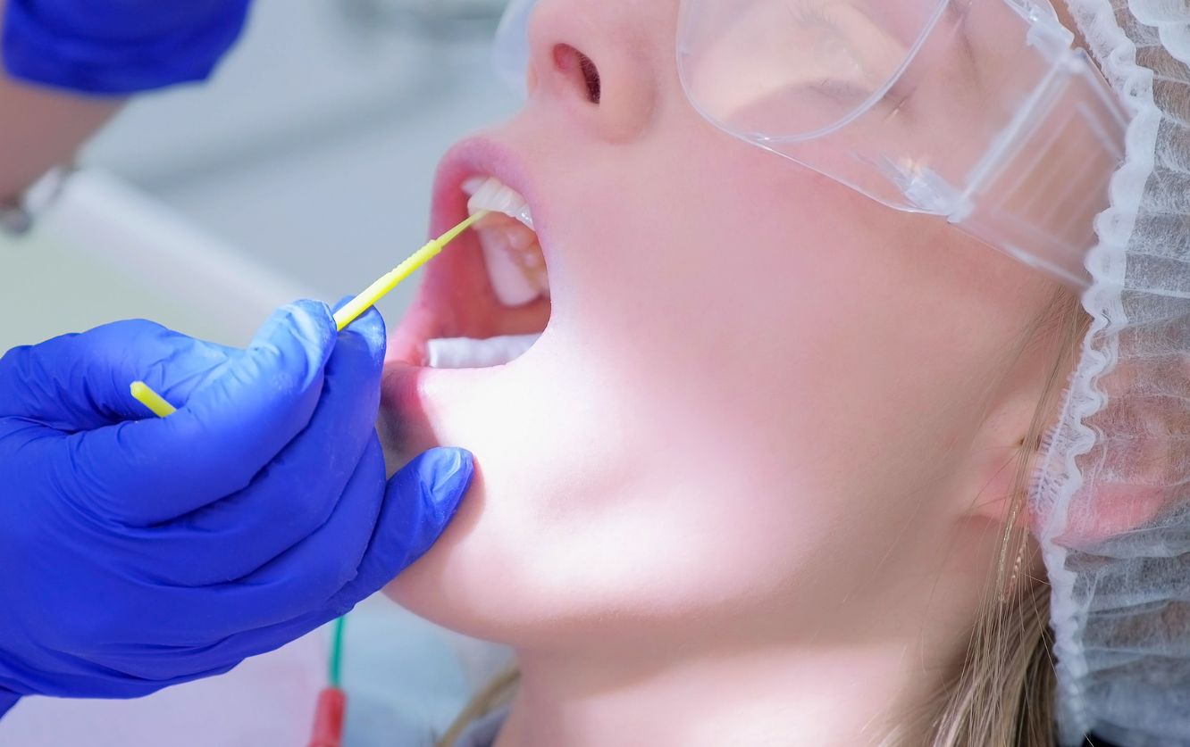 Close-up of a patient's open mouth under bright blue curing light during dental bonding or sealant application