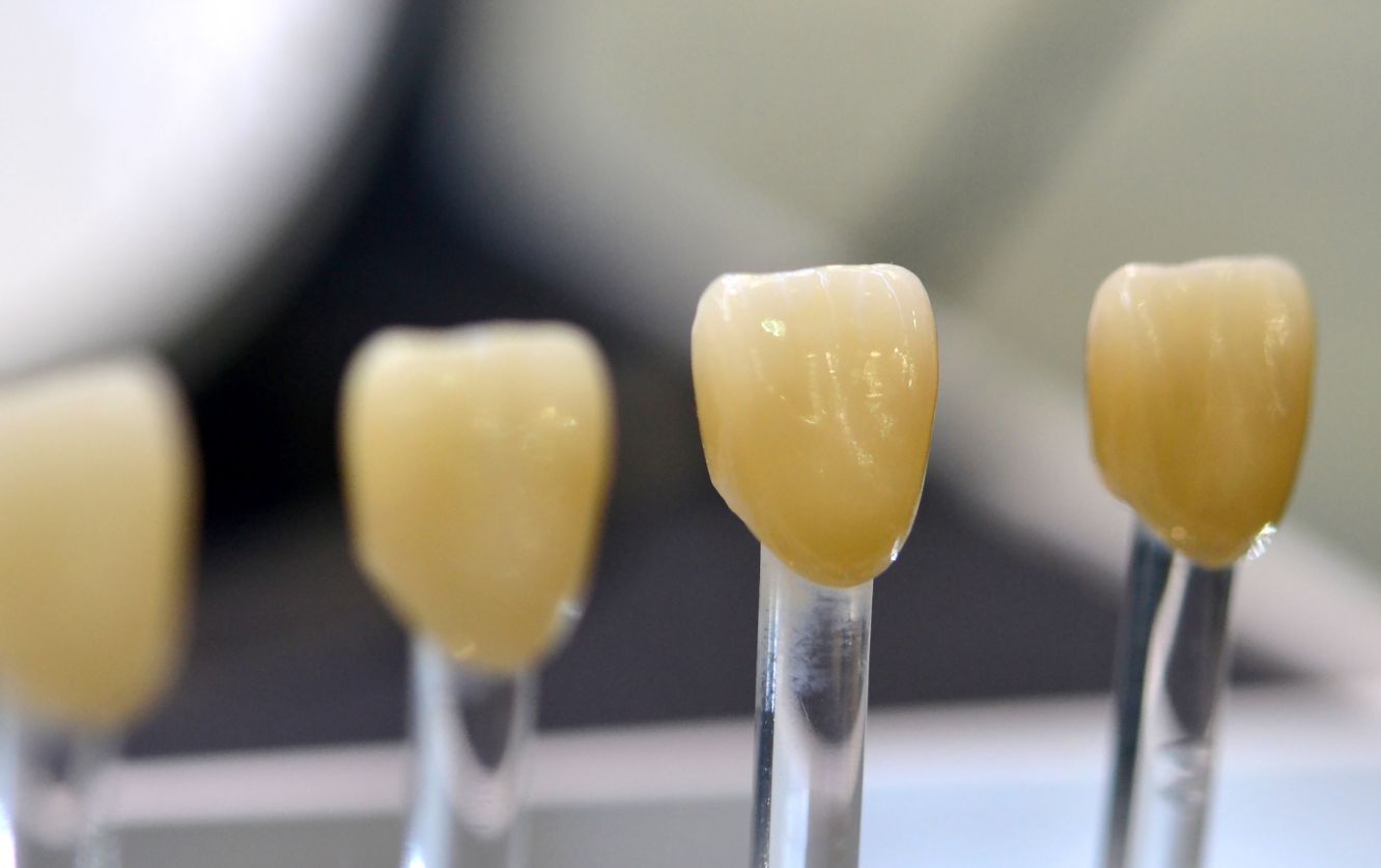 Dental shade guide with six porcelain samples lined up next to a natural tooth to help determine the closest color match for veneers or crowns in cosmetic dentistry