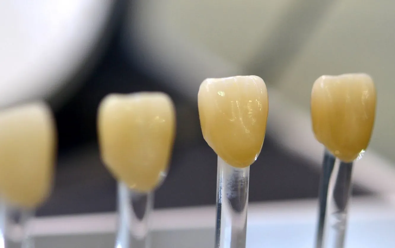 Dental shade guide with six porcelain samples lined up next to a natural tooth to help determine the closest color match for veneers or crowns in cosmetic dentistry