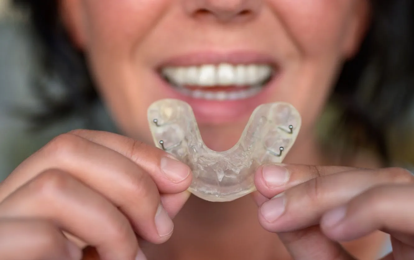 Woman smiling while gently inserting a set of transparent Invisalign aligners onto her upper teeth, demonstrating a step in the orthodontic process of clear aligner therapy for teeth straightening