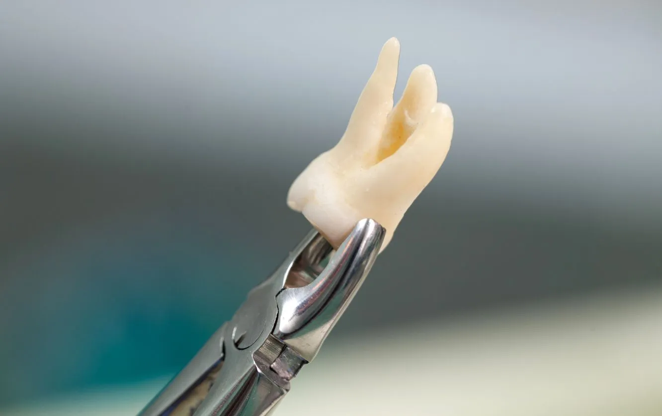 Macro image of a gloved hand holding a realistic titanium dental implant with abutment and porcelain crown, used for single-tooth replacement in restorative dental procedures