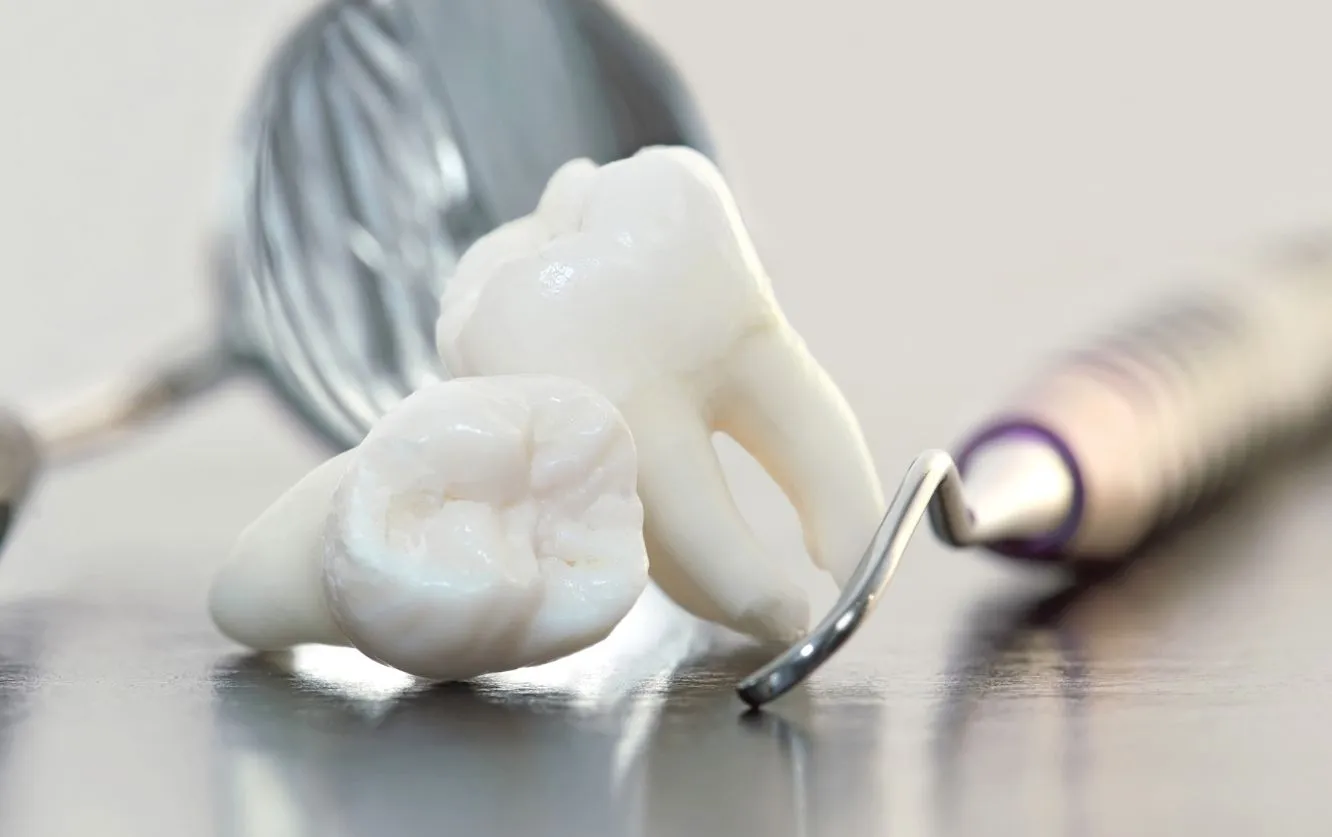 Sterile metal dental instruments, including a mirror and explorer, positioned next to a 3D molar model on a sterile surface, symbolizing precision in restorative dentistry