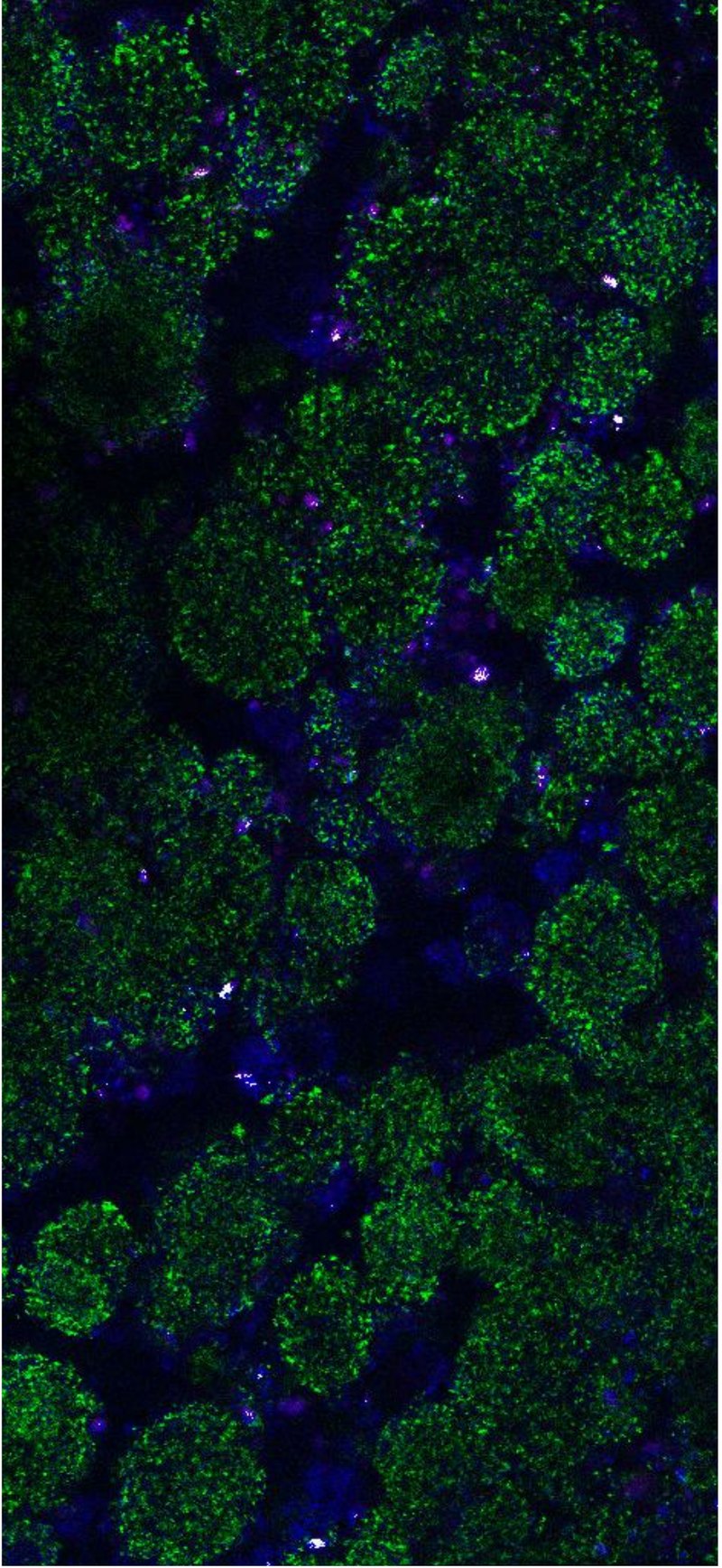 Confocal microscopy image of bacteria growing in Lung³Gel.