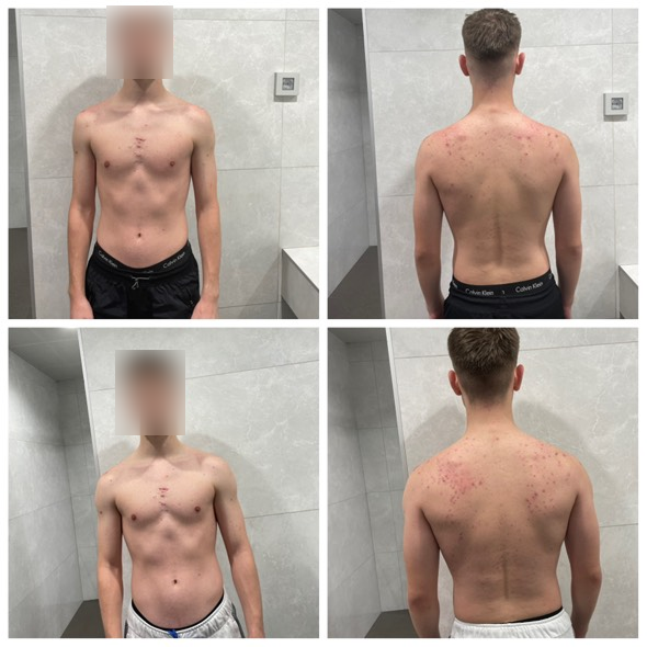 Tjelesna transformacija klijenta