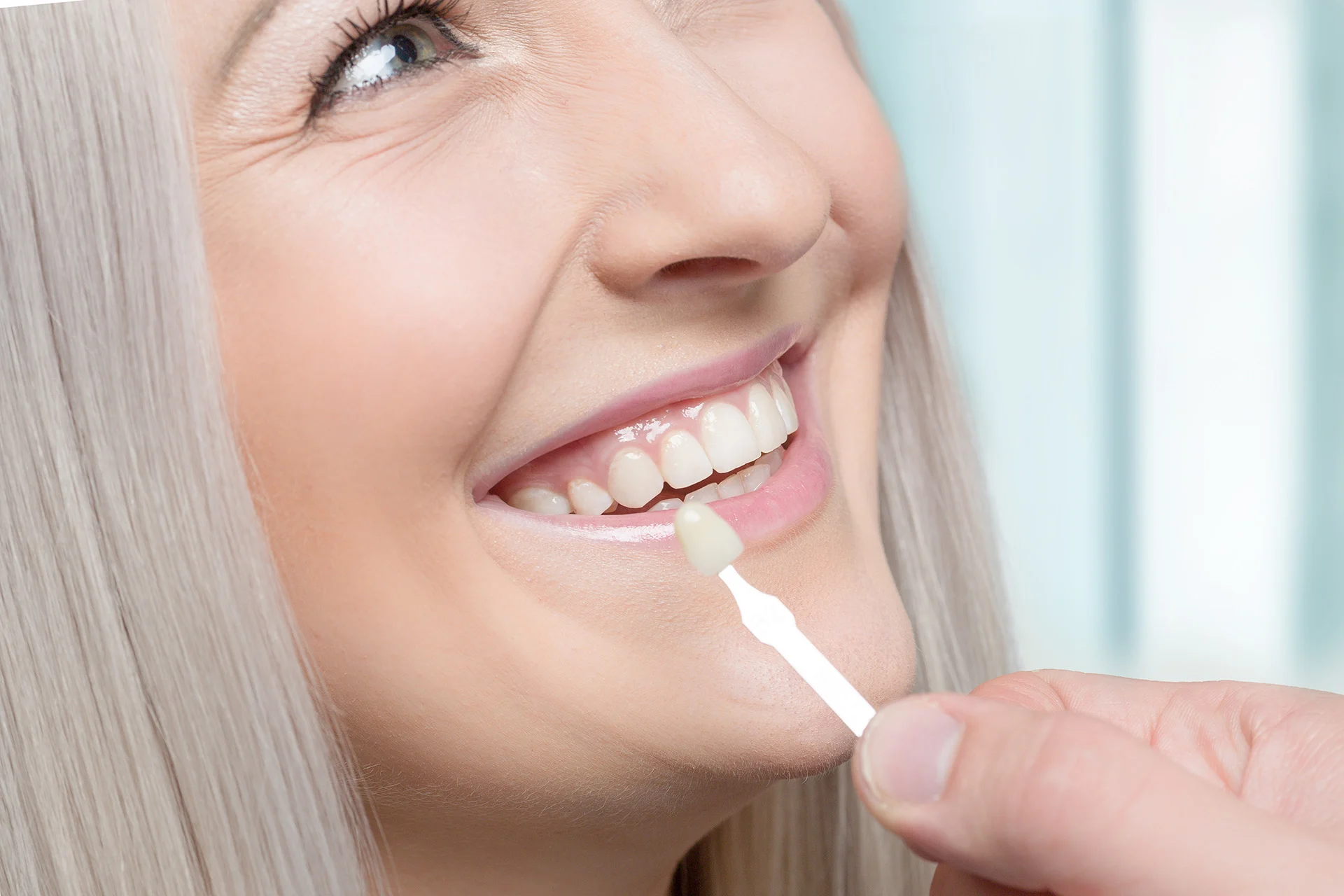 Dental Veneers in Medina