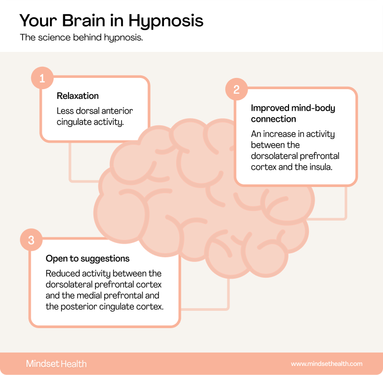 A diagram of the changes to the brain in hypnosis