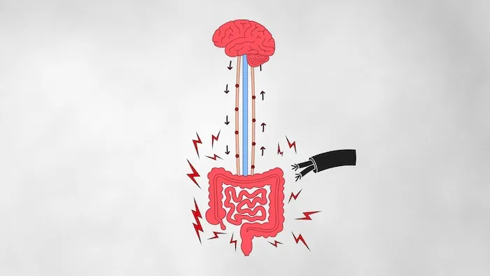 Hypersensitive gut nerve cell showing amplified pain signals in a gut-brain disorder