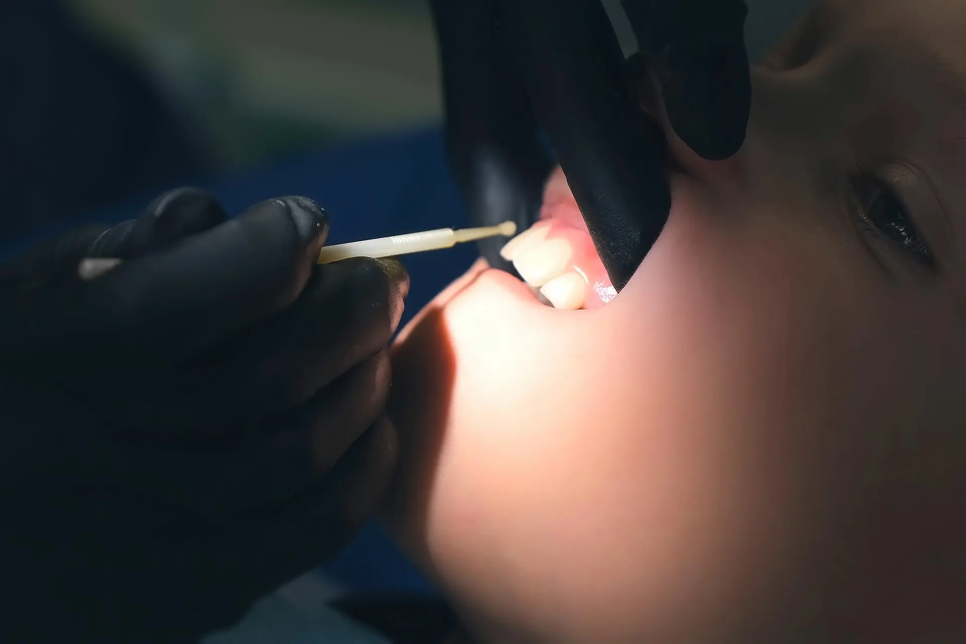 Dentist discussing silver diamine fluoride treatment options with a young patient