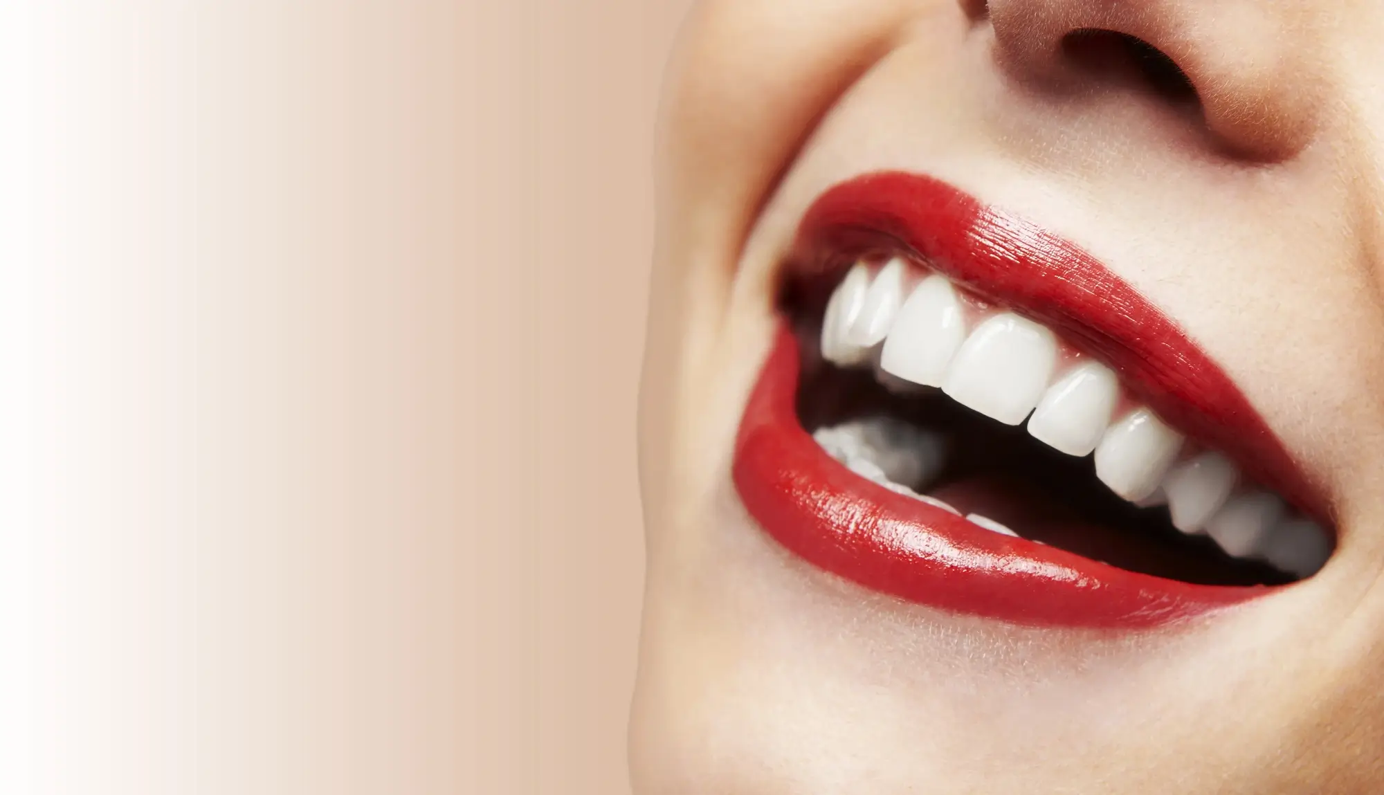 smile after same day crowns