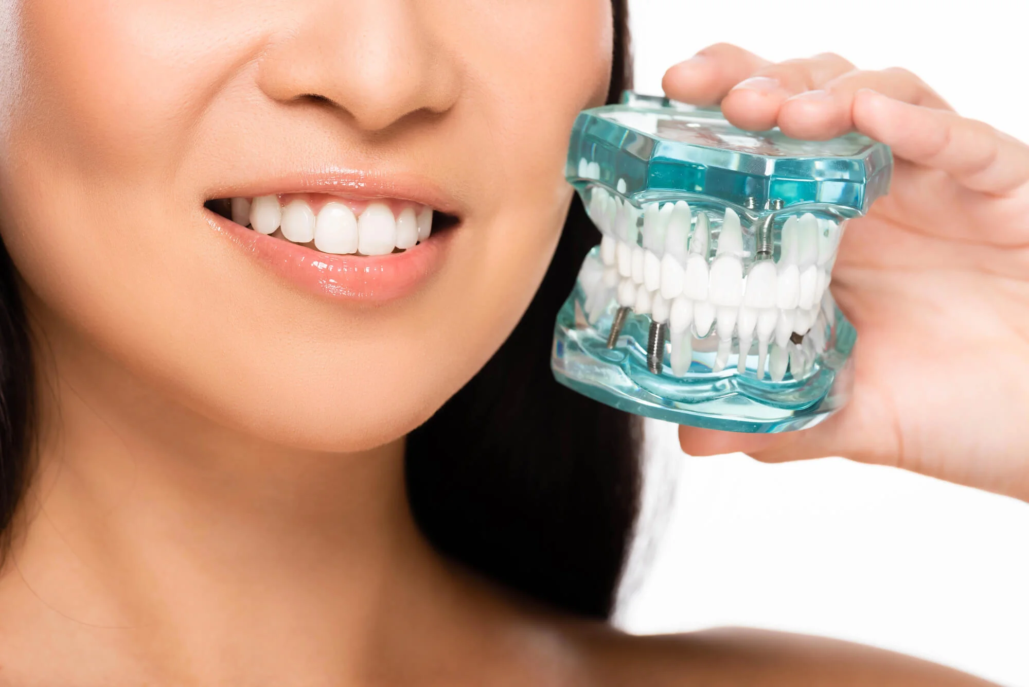 Natural smile transformation veneers near me