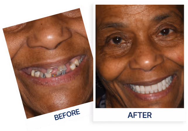 implant-dentistry
