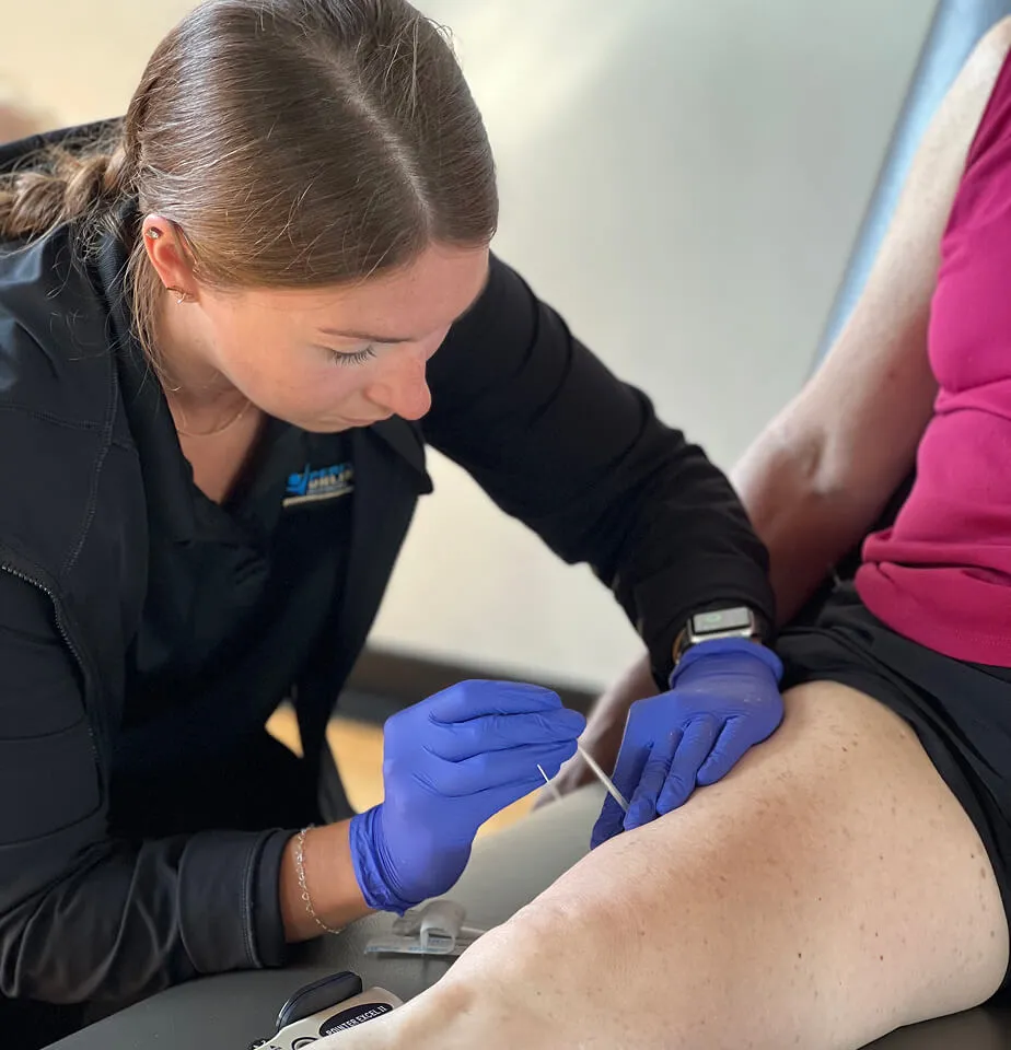 cece dry needling leg