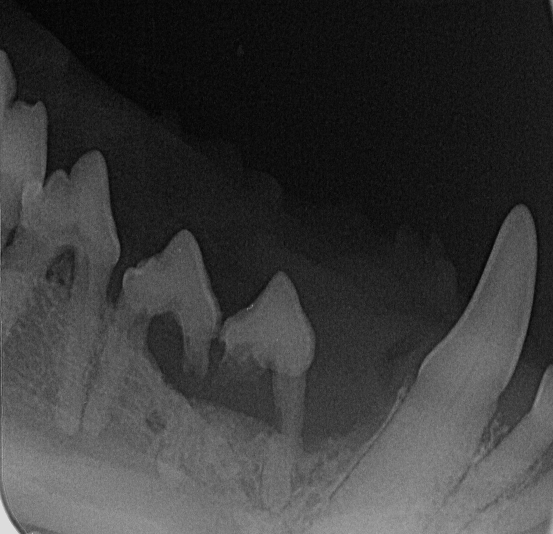 Dentale rontgenfoto