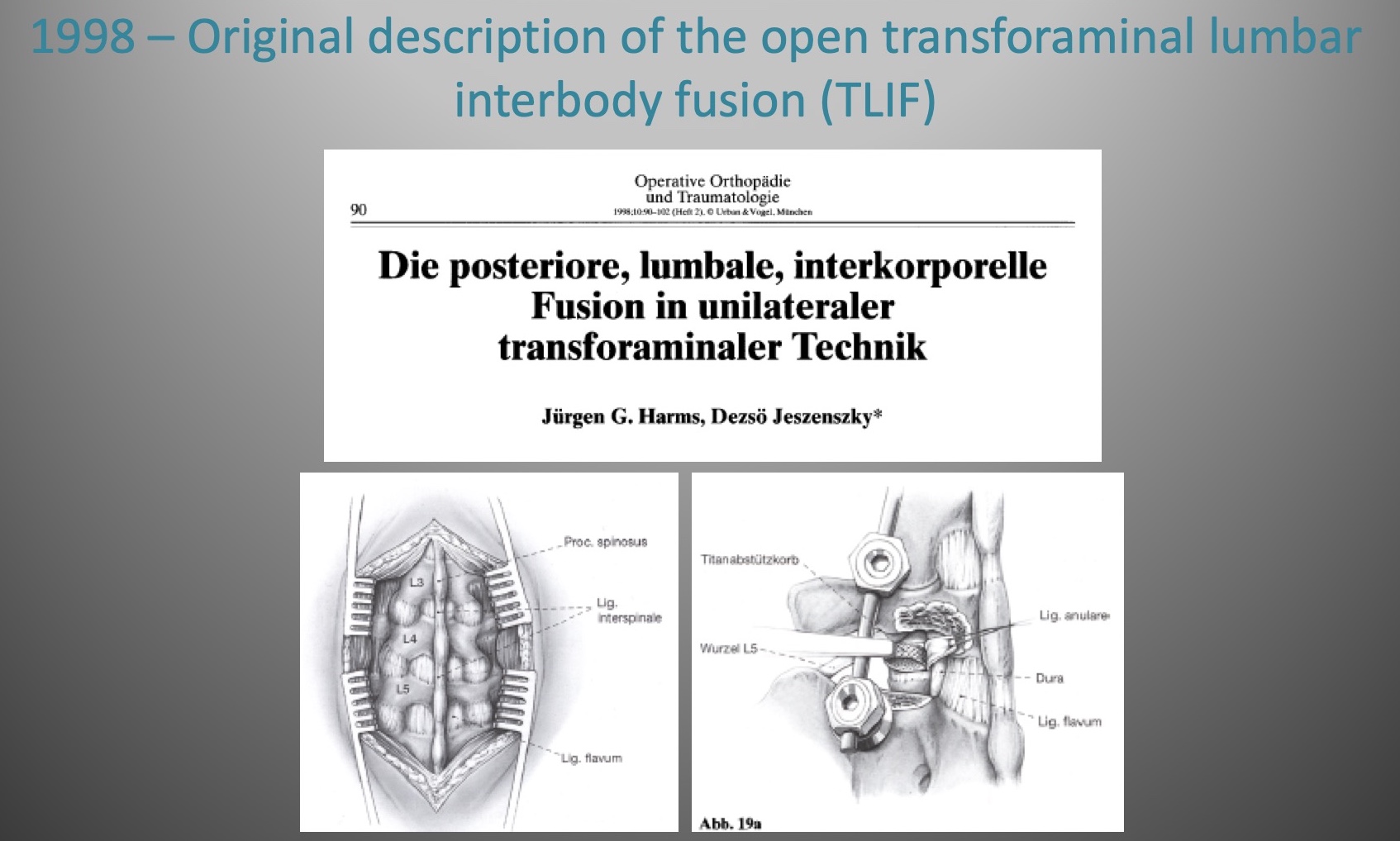 Fig 3: Harms 1998