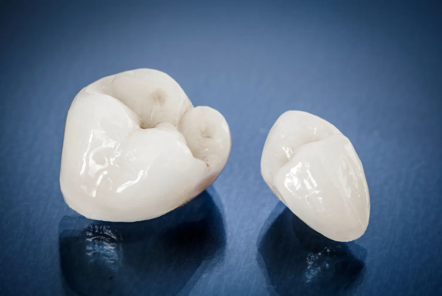 Dental Crowns in Alliston, ON