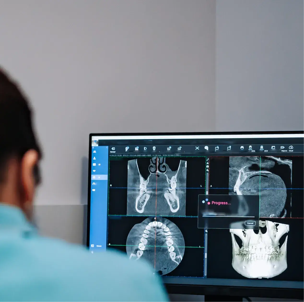Dental x-rays