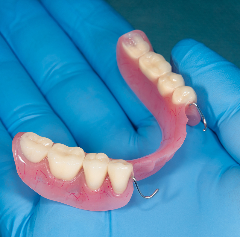 What Are Partial Dentures?