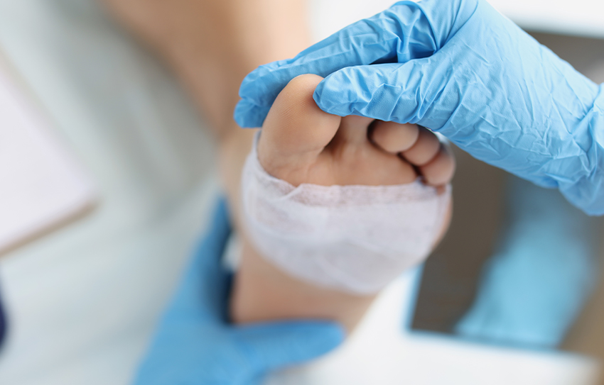 Doctor examines a patient’s foot with a diabetic foot ulcer in metro Atlanta