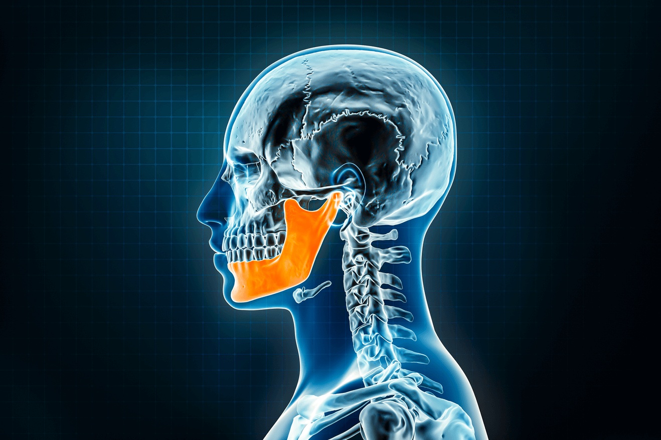 Graphic showing an outline of the mandible (jawbone) in a human skull, representing how HBOT can help heal osteoradionecrosis of the mandible