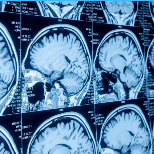 medical imaging brain scans