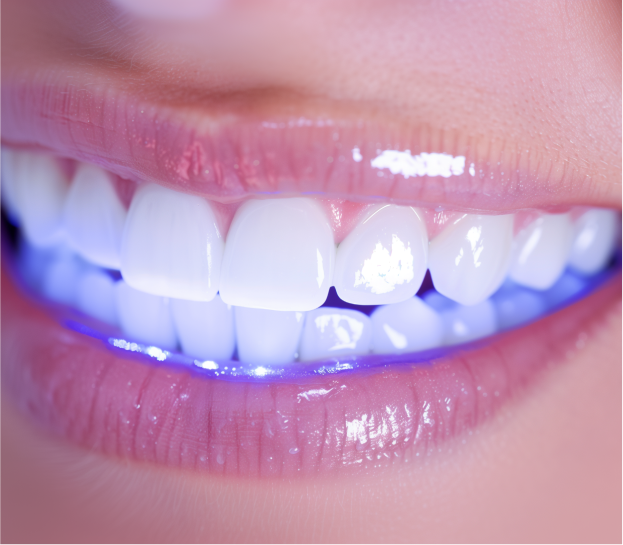 Professional Teeth Whitening vs. At-Home Kits: Which Is Right for You?