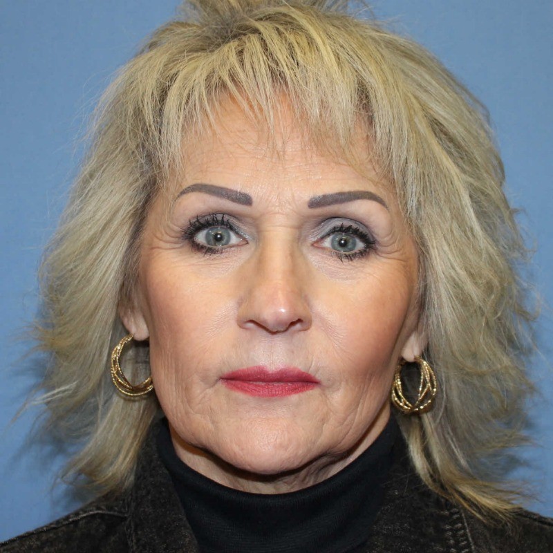 Teresa