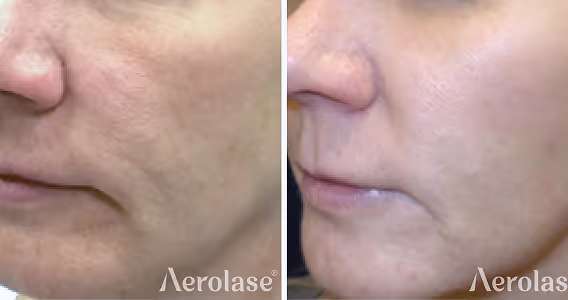 A before and after picture of a woman's face