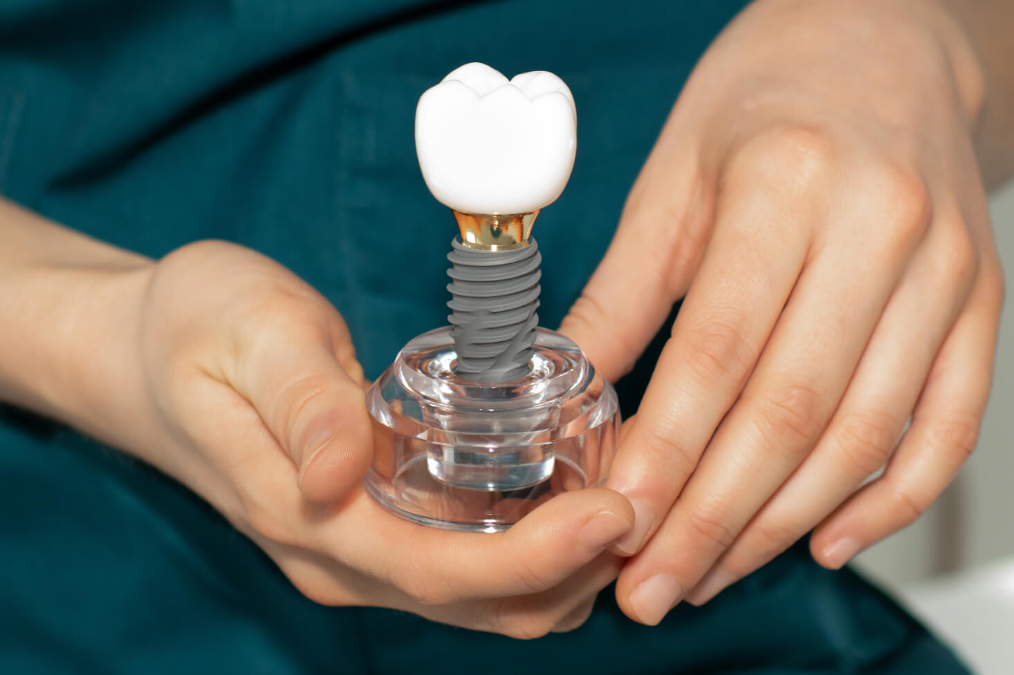 Close-up of a dental professional holding a model of a dental implant with a white crown and titanium screw.