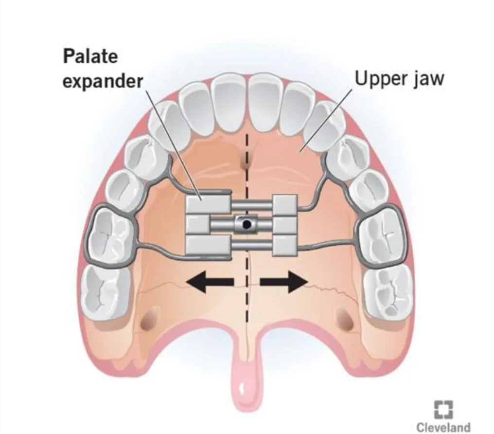 JuniorDental teeth