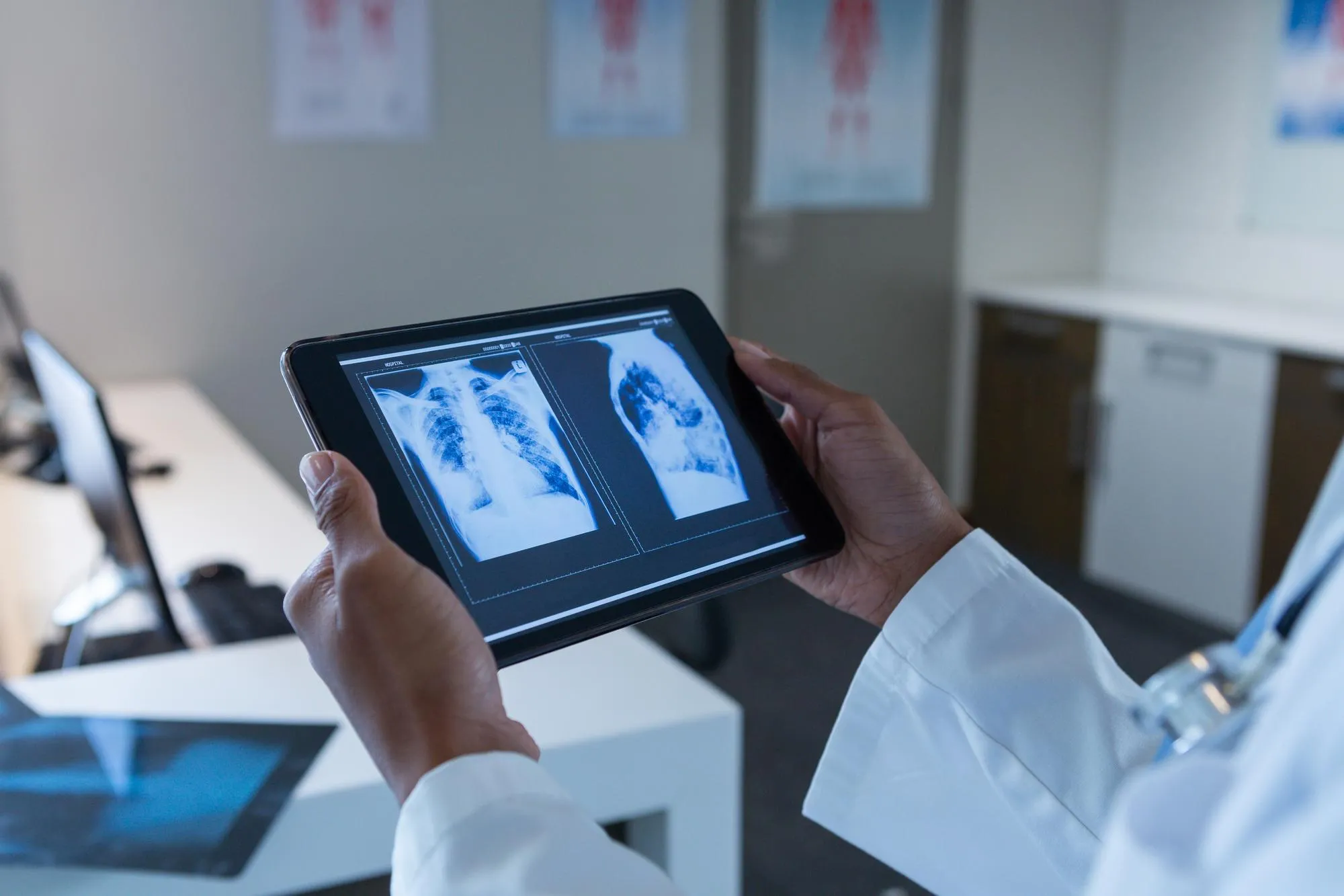 Physician reviewing body scan images on a tablet at Lifetime Performance Medicine in Los Gatos
