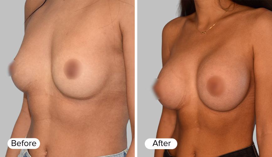 A side-by-side comparison image featuring two female figures. The left figure is labeled 'Before' and the right figure is labeled 'After', showcasing a change in appearance.
