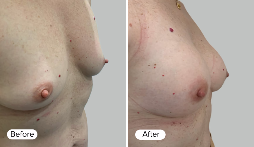 A side-by-side comparison image labeled 'Before' and 'After', showcasing variations in appearance.