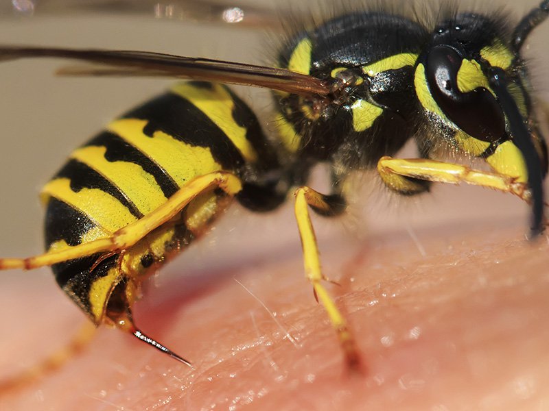wasp stinging human